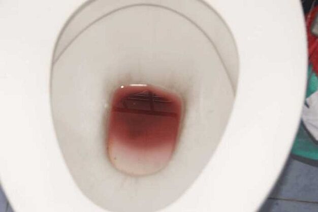 njolla tek meshkujt kur janë të emocionuar